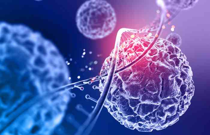 Workflow Optimization